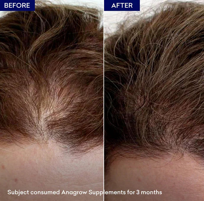 Jenpharm-Anagrow Anti Hair-Loss Capsule-30S