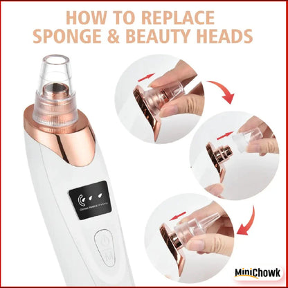 5-in-1 Blackhead Remover Bundle