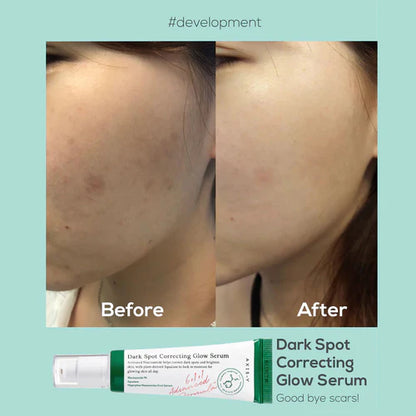 Axis-Y - Mini Dark Spot Correcting Glow Serum-5ml