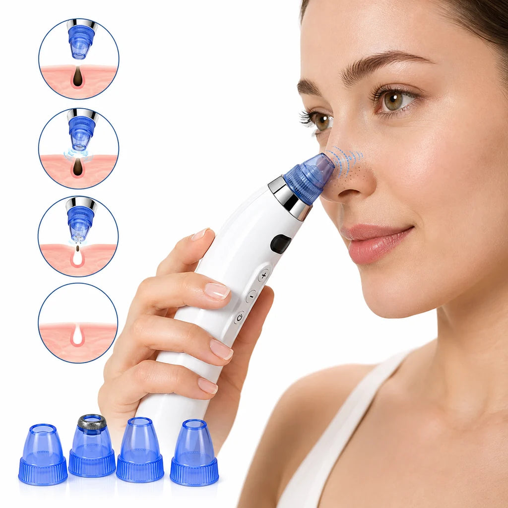 Electric Blackhead Removal