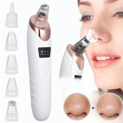 5-in-1 Blackhead Remover Bundle