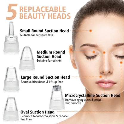 5-in-1 Blackhead Remover Bundle