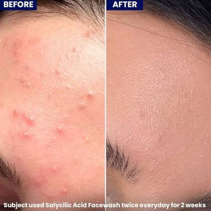 Jenpharm - Salicylic Acid Face Wash